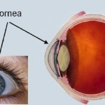 Paquimetría y glaucoma: ¿Por qué más es menos?