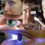 ¿Puedo tener glaucoma si mi tensión es normal? Glaucoma normotensivo