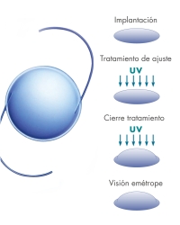 Lentes intraoculares autoregulables